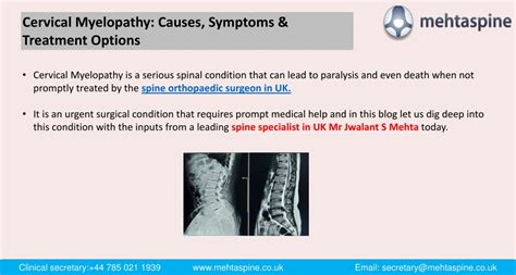 PPT - Cervical Myelopathy: Causes, Symptoms & Treatment Options PowerPoint Presentation - ID ...