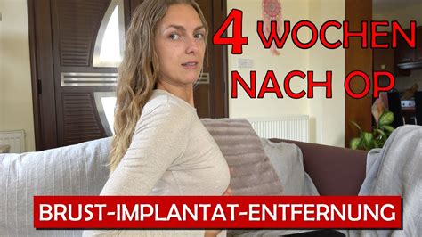 Wochen Nach Brust Implantat Entfernung Youtube