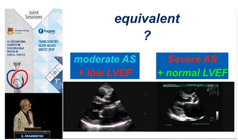 Moderate Aortic Stenosis With Reduced Ejection Fraction Can Imaging