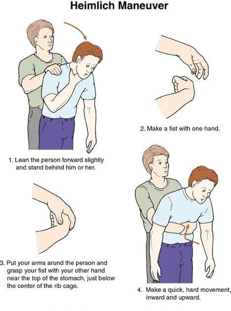 Heimlich Maneuver