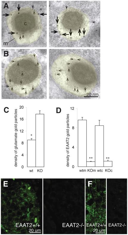 AB Immunogold Electron Micrographs Showing EAAT2 Large Gold