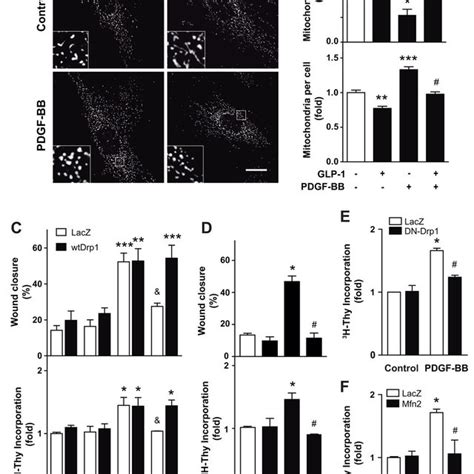 Glp Inhibits Pdgf Bb Induced Cell Migration And Proliferation A R