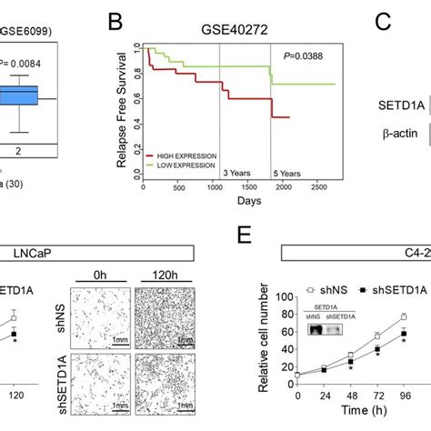 The Setd1a Foxm1 Axis Is Associated With Poor Prognosis Of Prostate