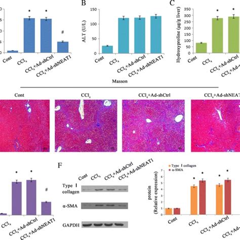 Silencing Neat1 Inhibited Ccl4 Induced Liver Fibrosis In Mice Neat1