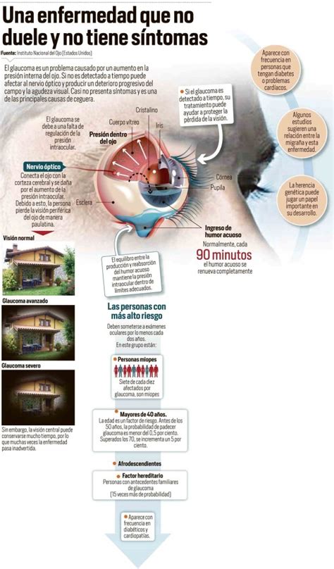 Que Es El Glaucoma Y Cuales Son Sus Consecuencias Infografías Y Remedios