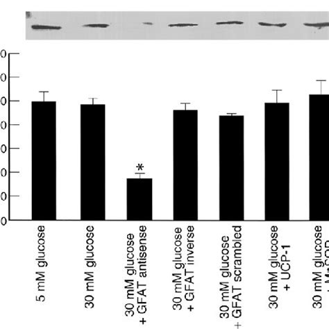 Effect Of GFAT Antisense Oligonucleotides On GFAT Expression Cells