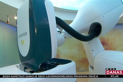 U Specijalnu Bolnicu Radiokirurgija Zagreb Stigao Je Najmoderniji Robot