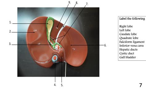 Solved Label The Following Structures Appendix