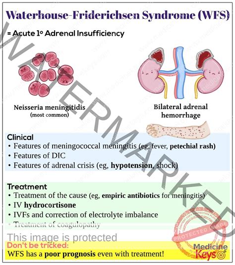 Waterhouse-Friderichsen syndrome (WFS) - Medicine Keys for MRCPs