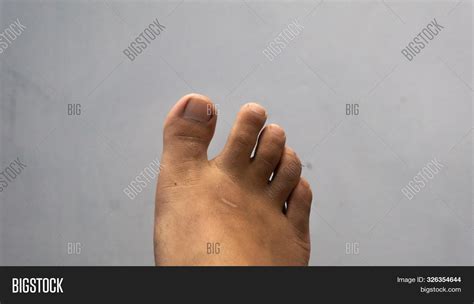 Close View Human Toes Image & Photo (Free Trial) | Bigstock