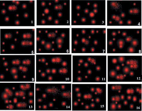 Comet Images Prepared By Single Cell Gel Electrophoresis Scge Show