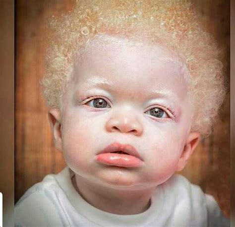 Pin By Wendy Nacol On Beautiful Albino Beautiful Children Little