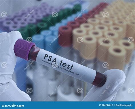 Psa Blood Test Stock Photo Image Of Male Prostate