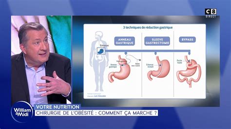 Résumé et casting Votre nutrition Chirurgie de l obésité comment ça