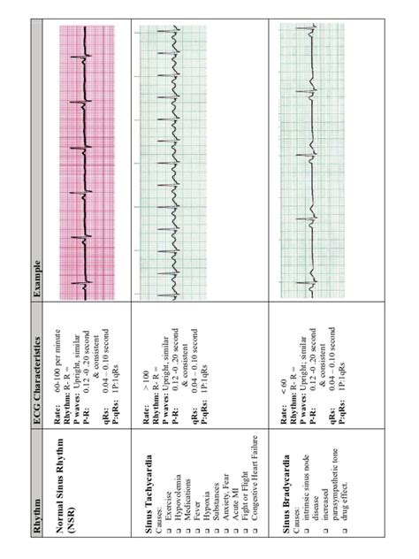 Ekg Flash Cards Pdf Pdf Electrocardiography Electrophysiology