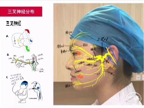 三叉神经解剖及三叉神经痛外科“三驾马车” 脑医汇 神外资讯 神介资讯