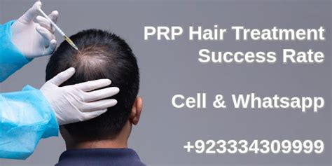 Top Image Prp In Hair Treatment Thptnganamst Edu Vn