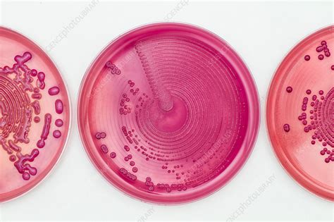 Bacteria Cultures In MacConkey Agar Stock Image C037 1716 Science