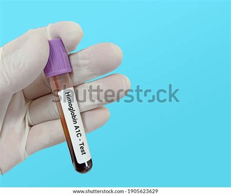 Biochemist Lab Technologist Holds Blood Sample Stock Photo