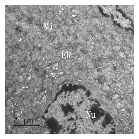 Transmission electron microscopy of mouse intestinal epithelial cells ...