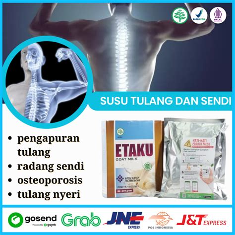 Jual Flashsale Etaku Disc Box Susu Untuk Tulang Dan Sendi Orang