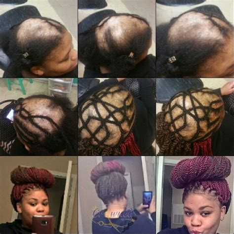 13+ Fine Beautiful Hairstyle To Cover Bald Spot Women