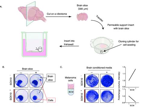 Ex Vivo Migration Patterns In SOX10 And SOX10 Melanoma Cells A