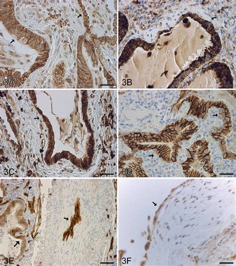 Ihc Staining For Claudin 1 2 3 4 5 And 7 In A Patient With Download Scientific