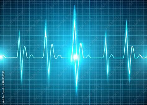 ecg waveform illustration   light blue background showcasing