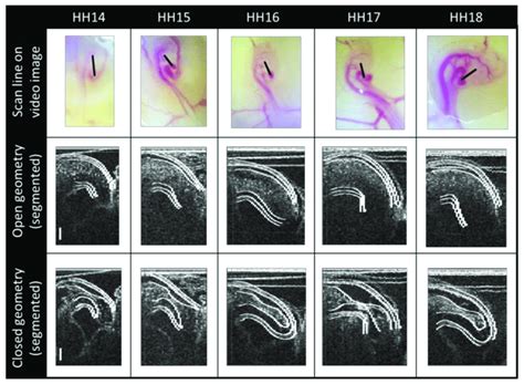 OCT Image Segmentation First Row The Longitudinal OCT Scan Location