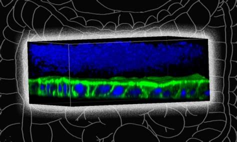 Gut Microbiome Crohns Disease Bacteria Grown In The Lab Healthcare