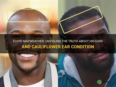 Floyd Mayweather Unveiling The Truth About His Ears And Cauliflower