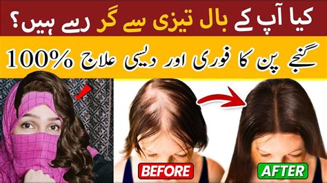 Natural Hair Home Remedies Hair Loss Treatment Simple Home Remedies To Prevent Hair Loss