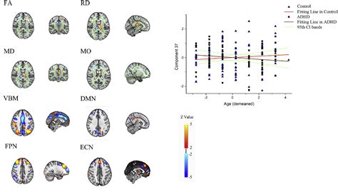 Figure From Neuroimage Clinical Linked Anatomical And Functional