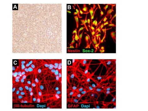 Rencell® Vm Human Neural Progenitor Cell Line Scc008