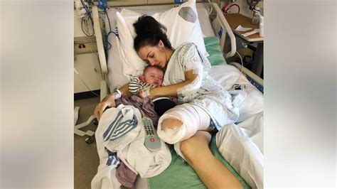 Mom Grateful To Be Alive After Losing Leg In Horror Motorcycle Accident Tgihealthcareerp