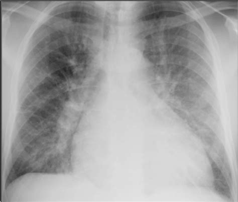 Doctors Network Chest Radiograph Of Different Conditions