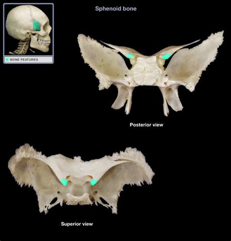 Sphenoid Bone Markings Flashcards Quizlet