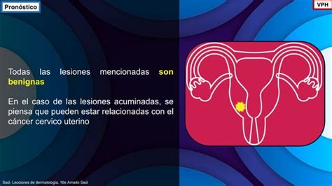 Virosis Herpes Virus VPH Molusco Contagioso PPT