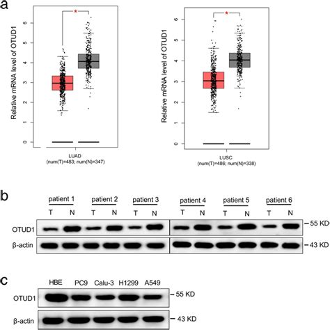 The Deubiquitinase Otud Inhibits Nonsmall Cell Lung Cancer