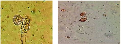 Cyst Of Balantidium Coli Figure 10 Cercaria Larvae Download Scientific Diagram