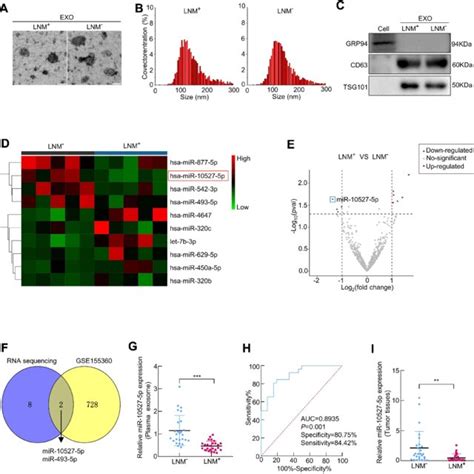 Proposed Model Of Exosomal Mir P Mediated Migration Invasion