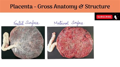 The Placenta Gross Anatomy Measurements Structure Placental