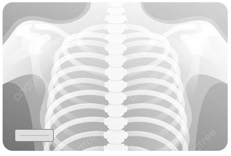 X Ray Of Human Thoraxchest Doctor Xray Scan Vector Doctor Xray Scan