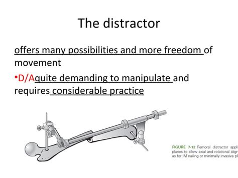 principles of internal fixation | PPT