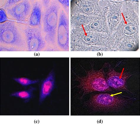 Morphological Changes Induced In Hct After H Treatment With