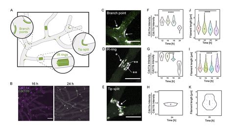 JCellBiol On Twitter A Gene Duplication Of A Septin Reveals A