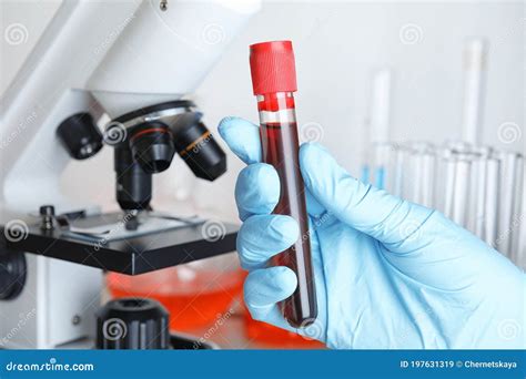 Scientist Holding Test Tube With Blood Sample Near Microscope Closeup