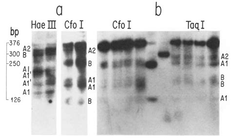 Mapping Of The Micrococcal Nuclease Sensitive Sites On S Chromatin A