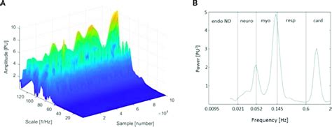 A Three Dimensional Wavelet Transform WT Of The Laser Doppler LD